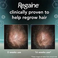 Regaine® For Men Foam 5% 73ml