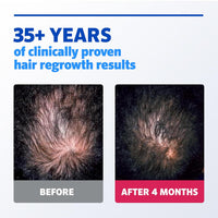 Rogaine Men’s 5% Minoxidil Topical Solution 3 Month Supply