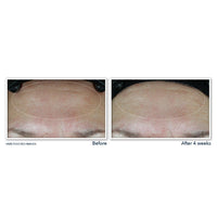 Roc Multi Correxion Hydrate+ Plump Moisturizer Spf 30