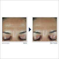 RoC RETINOL CORREXION Deep Wrinkle Filler 30 ml