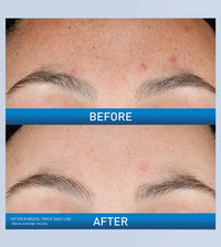Cerave Resurfacing Retinol Serum 30 ML
